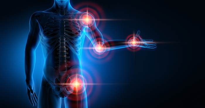 Joint Pain